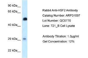 WB Suggested Anti-HSF2 Antibody   Titration: 1. (HSF2 antibody  (N-Term))