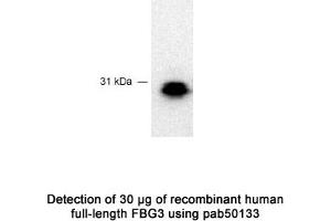 Image no. 1 for anti-F-Box Protein 44 (FBXO44) (C-Term) antibody (ABIN363442) (FBXO44 antibody  (C-Term))