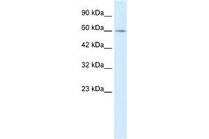 WB Suggested Anti-MYEF2 Antibody Titration:  0. (MYEF2 antibody  (Middle Region))
