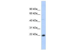 CD40 antibody used at 1 ug/ml to detect target protein. (CD40 antibody  (N-Term))