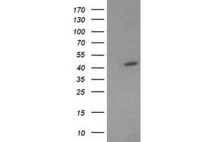 Image no. 1 for anti-Mitogen-Activated Protein Kinase Kinase 1 (MAP2K1) antibody (ABIN1499383) (MEK1 antibody)