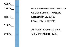 WB Suggested Anti-RAB11FIP5  Antibody Titration: 0. (RAB11FIP5 antibody  (N-Term))