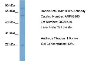 WB Suggested Anti-RAB11FIP5  Antibody Titration: 0.