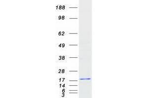 Validation with Western Blot