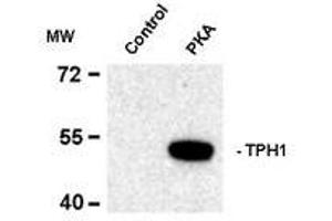 Western blots of recombinant tryptophan hydroxylase incubated in the absence (Control) and presence of cAMP-dependent protein kinase (PKA) showing specific immunolabeling of the ~53k tryptophan hydroxylase protein phosphorylated at Ser58. (Tryptophan Hydroxylase 1 antibody  (pSer58))