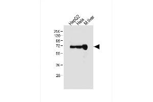 All lanes : Anti-ALB Antibody (C-term) at 1:1000 dilution Lane 1: HepG2 whole cell lysate Lane 2: Hela whole cell lysate Lane 3: Mouse liver tissue lysate Lysates/proteins at 20 μg per lane. (Albumin antibody  (C-Term))