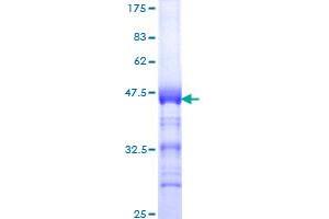 TOP2B Protein (AA 1411-1523) (GST tag)