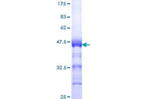 TOP2B Protein (AA 1411-1523) (GST tag)