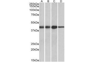 Western blot analysis: ACAT1 antibody staining of Mouse (A) and Rat (B) kidney lysates, and Mouse (C) and Rat (D) Liver lysates at 0.