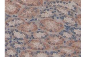 Detection of GAL8 in Human Kidney Tissue using Polyclonal Antibody to Galectin 8 (GAL8) (LGALS8 antibody  (AA 1-317))
