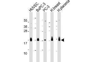 All lanes : Anti-CD59 Antibody (Center) at 1:2000 dilution Lane 1: HUVEC whole cell lysate Lane 2: BxPC-3 whole cell lysate Lane 3: PC-3 whole cell lysate Lane 4: Human breast lysate Lane 5: Human placenta lysate Lysates/proteins at 20 μg per lane. (CD59 antibody  (AA 74-110))