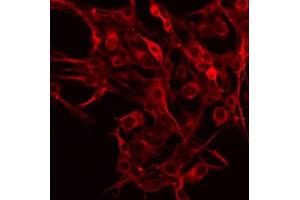 ABIN6266860 staining HeLa by IF/ICC. (Ephrin A5 antibody  (Internal Region))