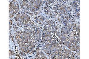 IHC analysis of TRMT61B using anti-TRMT61B antibody (ABIN7602334). (TRMT61B antibody  (AA 7-477))