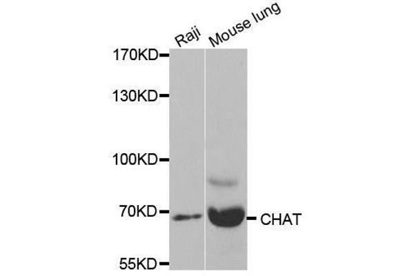 Choline Acetyltransferase antibody  (AA 331-630)