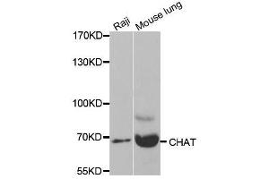 Western blot analysis of extracts of various cell lines, using CHAT antibody. (Choline Acetyltransferase antibody  (AA 331-630))