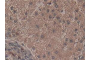 Immunohistochemistry (IHC) image for anti-Fibromodulin (FMOD) (AA 19-376) antibody (ABIN7433693)