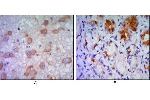 Immunohistochemical analysis of paraffin-embedded human brain tissue (A) and stomach tissue (B), showing cytoplasmic localization using ERN1 mouse mAb with DAB staining. (ERN1 antibody)
