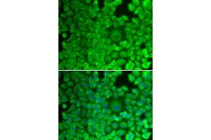 Immunofluorescence (IF) image for anti-Glycogen Synthase 1 (Muscle) (GYS1) antibody (ABIN1872925)