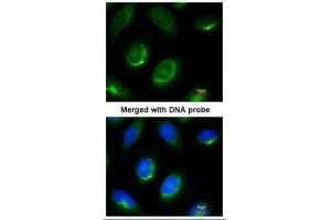 ICC/IF Image Immunofluorescence analysis of paraformaldehyde-fixed HeLa, using Laminin beta-1, antibody at 1:100 dilution. (Laminin beta 1 antibody  (C-Term))