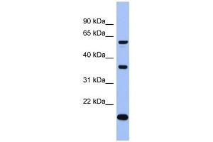 LARP6 antibody used at 1 ug/ml to detect target protein. (LARP6 antibody  (Middle Region))