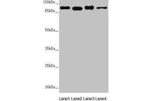 Western blot All lanes: DHTKD1 antibody at 1. (DHTKD1 antibody  (AA 1-280))