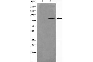 Western blot analysis on HuvEc cell lysate using Phospho-Nibrin(Ser278) Antibody，The lane on the left is treated with the antigen-specific peptide. (Nibrin antibody  (pSer278))