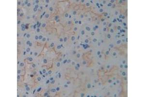 Figure. (ICAM1 antibody  (AA 41-464))