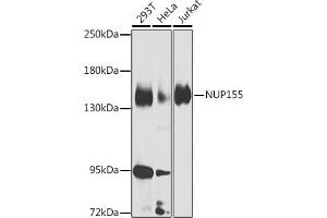 Western blot analysis of extracts of various cell lines, using NUP155 Antibody (ABIN6128363, ABIN6144953, ABIN6144954 and ABIN6223714) at 1:1000 dilution. (NUP155 antibody  (AA 1102-1391))