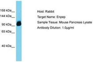 Image no. 1 for anti-Glutamyl Aminopeptidase (Aminopeptidase A) (ENPEP) (C-Term) antibody (ABIN6750514) (ENPEP antibody  (C-Term))