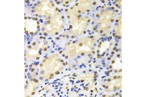 Immunohistochemistry of paraffin-embedded human kidney using HDGF Antibody.