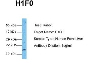 Host: Rabbit Target Name: H1F0 Sample Tissue: Human Fetal Liver Antibody Dilution: 1.