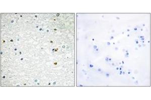 Immunohistochemistry analysis of paraffin-embedded human brain, using PARP3 Antibody. (PARP3 antibody  (AA 10-59))