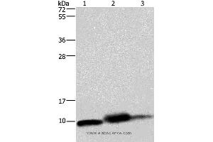 Western blot analysis of Mouse heart, human fetal liver and hepatocellular carcinoma tissue,, using COX6B1 Polyclonal Antibody at dilution of 1:1150 (COX6B1 antibody)