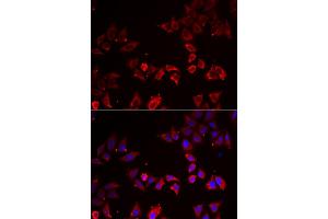 Immunofluorescence analysis of A549 cells using LIMS1 antibody (ABIN6293172).