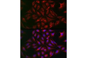Immunofluorescence analysis of U2OS cells using  Rabbit pAb (ABIN7265789) at dilution of 1:50 (40x lens). (ATG12 antibody  (AA 1-74))