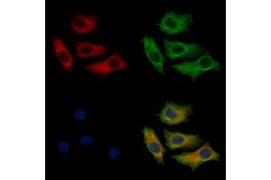 ABIN7093853 and ABIN7097896 staining HepG2 cells by IF/ICC. (CTPS2 antibody  (C-Term))