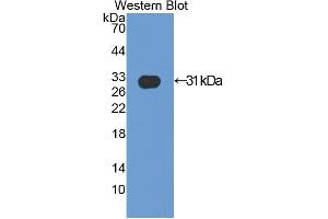 Western blot analysis of the recombinant protein. (ACTN2 antibody  (AA 1-254))