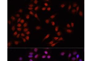 Immunofluorescence analysis of HeLa cells using PRDM14 Polyclonal Antibody at dilution of 1:100. (PRDM14 antibody)