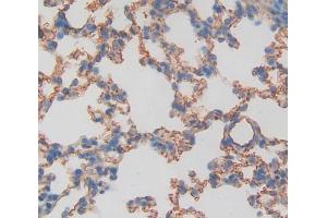 Used in DAB staining on fromalin fixed paraffin- embedded lung tissue (TIE1 antibody  (AA 435-609))