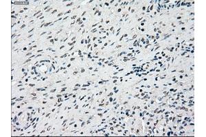 Immunohistochemical staining of paraffin-embedded lung tissue using anti-SSBmouse monoclonal antibody. (SSB antibody)