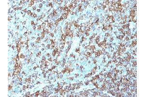 Formalin-fixed, paraffin-embedded human Tonsil stained with HLA-DRB Monoclonal Antibody (LN-3).