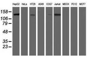 Image no. 2 for anti-Histone Deacetylase 6 (HDAC6) antibody (ABIN1498618) (HDAC6 antibody)