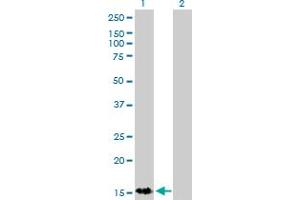 Western Blot analysis of S100A9 expression in transfected 293T cell line by S100A9 monoclonal antibody (M13), clone 1C22. (S100A9 antibody  (AA 1-114))