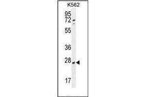 Western blot analysis of hCG_2024410 Antibody (C-term) in K562 cell line lysates (35ug/lane). (hCG_2024410 (AA 187-215), (C-Term) antibody)