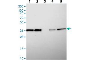 Western blot analysis of Lane 1: RT-4, Lane 2: U-251 MG, Lane 3: Human Plasma, Lane 4: Liver, Lane 5: Tonsil with CHORDC1 polyclonal antibody  at 1:250-1:500 dilution.