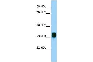 Host: Rabbit Target Name: FBXO17 Sample Type: HepG2 Whole Cell lysates Antibody Dilution: 1. (FBXO17 antibody  (N-Term))