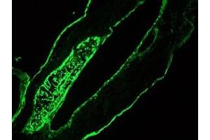 Image no. 1 for anti-pan Keratin (panKRT) antibody (ABIN959483) (pan Keratin antibody)