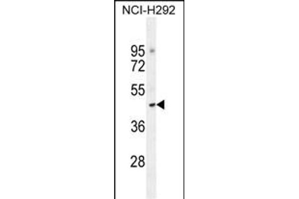 TJAP1 antibody  (N-Term)