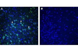 Expression of SEZ6 in rat temporal cortex.