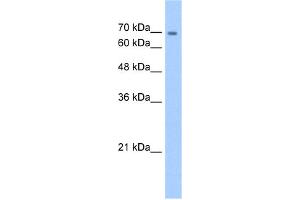 WB Suggested Anti-CDH22 Antibody Titration:  5.